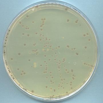 e coli colony